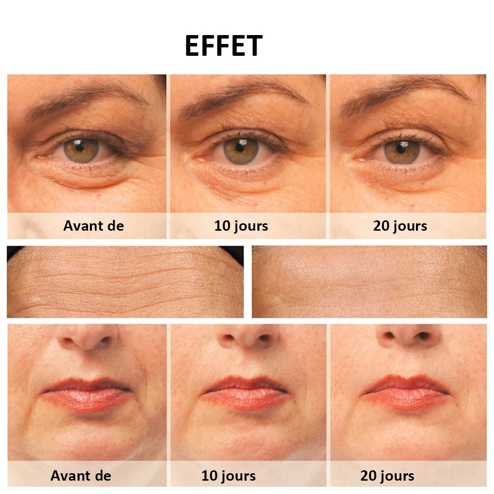 Masseur Facial RF EMS - Radiofréquence & Microcourant Lifting - badassmood