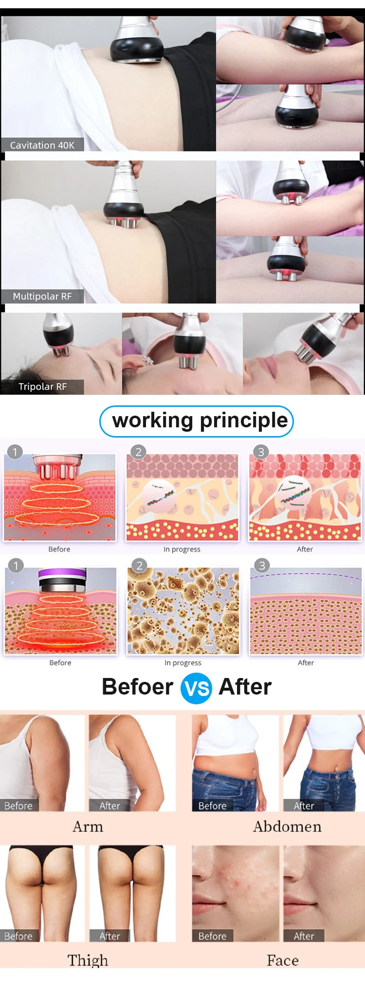 Appareil Minceur 3 en 1 Cavitation - Masseur Corps Visage Raffermissant Spa - badassmood