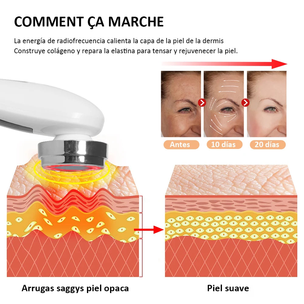 Masseur Facial RF EMS - Radiofréquence & Microcourant Lifting - badassmood